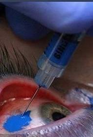 tatuaggio dell'occhio: tatuaggio fluorescente sull'occhio