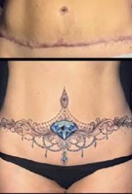 a set of tattoo renderings covered by female abdominal scars