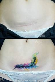 Feather tattoo tattoo covering the scar